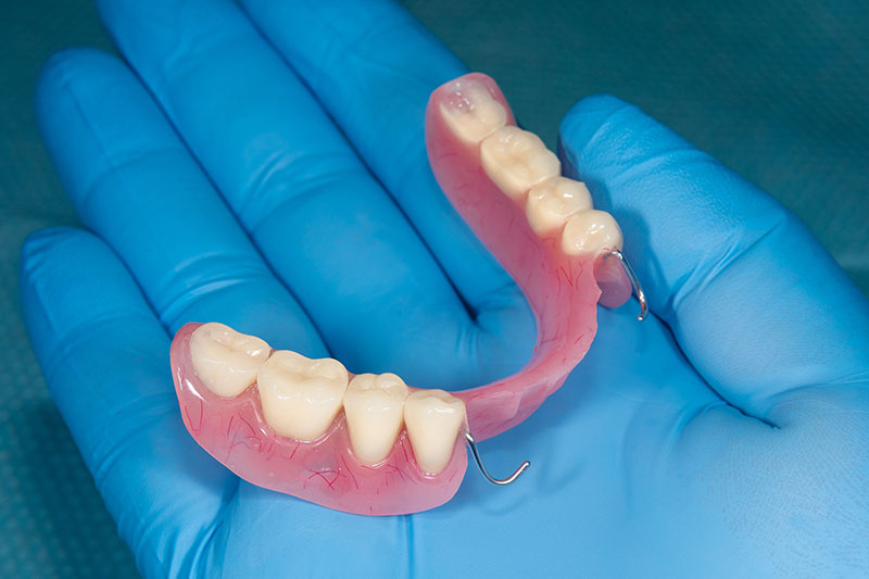 Partial Dentures St Catharines
