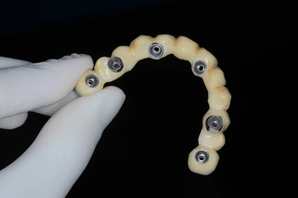 implant supported dentures near you